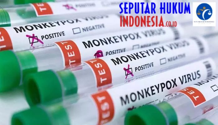 Dinkes DKI : Vaksinasi Cacar Monyet Dosis Kedua Telah Diberikan ke 416 Orang